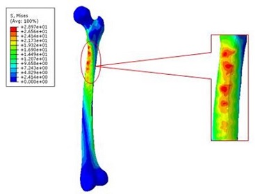原始股骨的最大Mises 应力.jpg