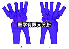 医学有限元分析.png